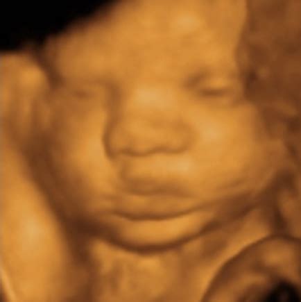 33 weeks - 3D 4D HD Live Ultrasound