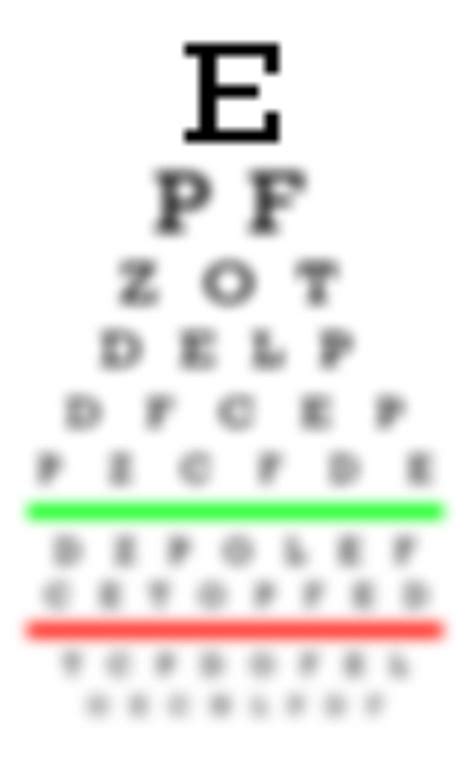 Myopia and Hypermetropia: Symptoms & Treatment - Vue Vision