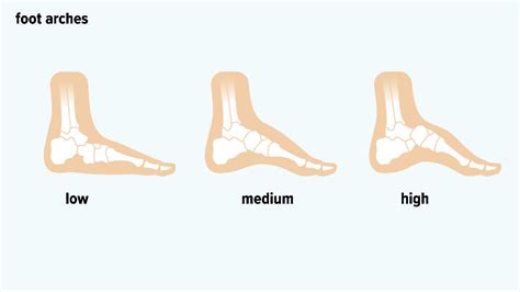 Types Of Foot Arches