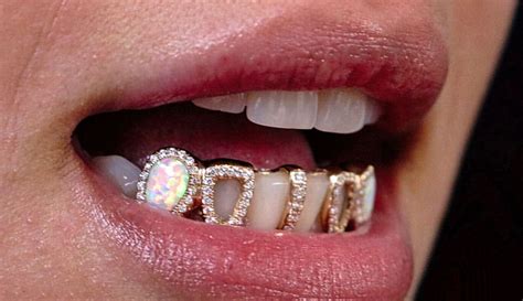 Madonna and Kim Kardashian choose MD Periodontics for perfect-fitting ...