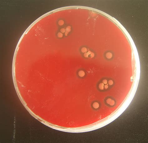 Hemolysis On Blood Agar Plate - cloudshareinfo