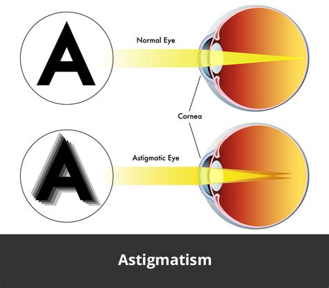 Astigmatism Test Chart Pdf