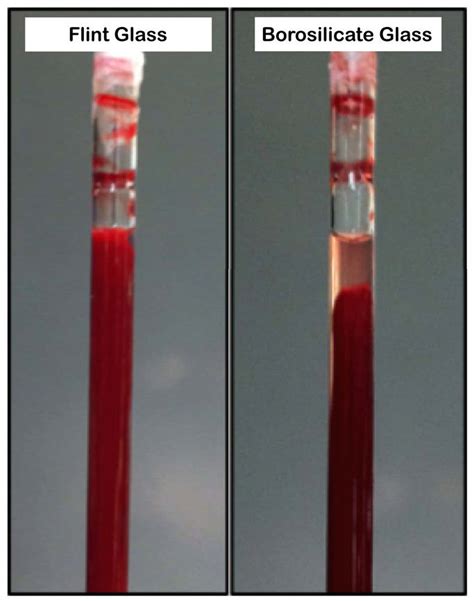 Macroscopic views of each blood clot model prior to treatment. Left ...