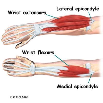 Wrist extensors (pronated ulnar-pinky side) Wrist flexors (supinated ...