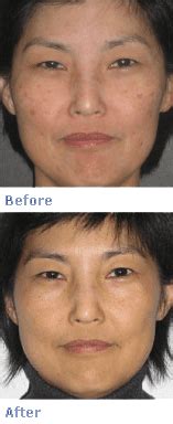 Obagi Nu-Derm System | Central Florida Eye Institute Ocala FL