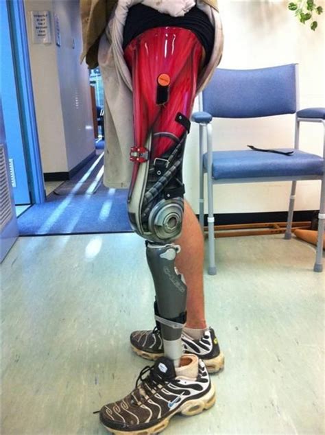 An awesome cybernetic leg Prosthetic Device, Prosthetic Leg, Robotic ...