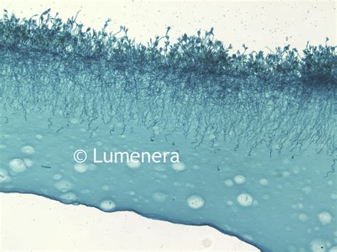 Microscope World Blog: Penicillium Under the Microscope