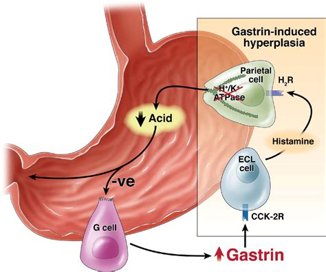 Gastrin in Gastrointestinal Diseases - Gastroenterology