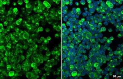 CD74 Antibody (NBP1-33109) | Bio-Techne