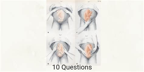 Leopold’s Maneuver Practice Exam - RNpedia