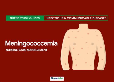 Meningococcemia Nursing Care Management (Study Guide) - Nurseslabs