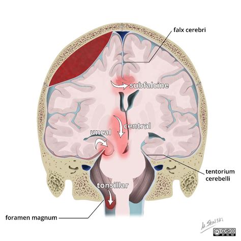 Pin on Neuroscience