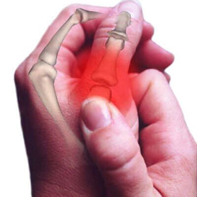 What Causes Hand and Wrist Pain? - Step To Health