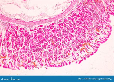 Tissue of Stomach Human Under the Microscope in Lab. Stock Photo ...