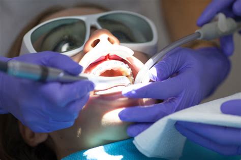 What Is Soft Tissue Dental Laser Technology?