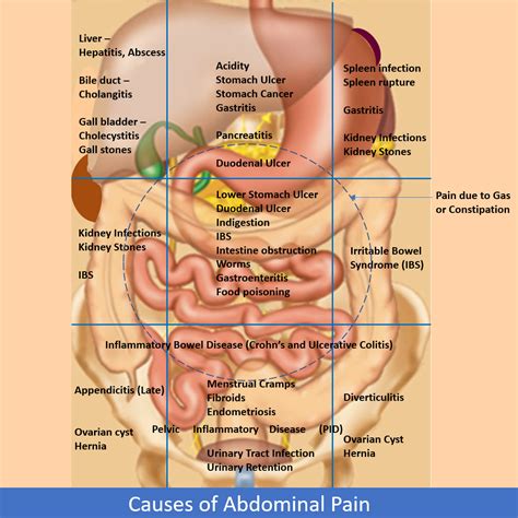Abdominal Pain Causes and its appropriate action - Dr. Varsha