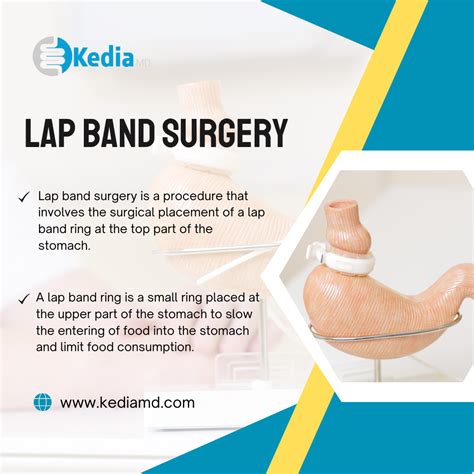 Lap Band Surgery Truth Bomb: The Gritty Pros & Cons | Dallas, Tx