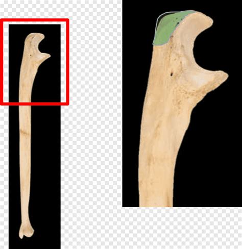 Olecranon Coronoid process of the ulna Ulnar styloid process Trochlear notch, class room ...