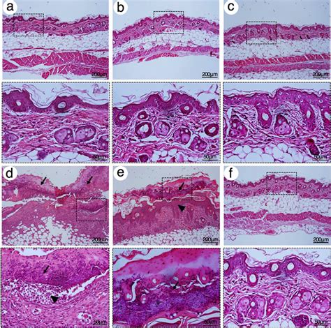 Representative H&E photographs of mouse skin after 7 days of topical ...