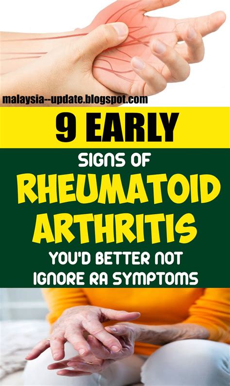 HERE ARE 9 EARLY SIGNS OF RHEUMATOID ARTHRITIS YOU'D BETTER NOT IGNORE RA SYMPTOMS