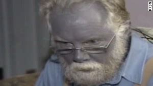 What killed the man with blue skin? - CNN Video