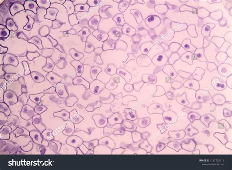 Meiosis Animal Cell Under Microscope Education Foto stock 1131725216 ...