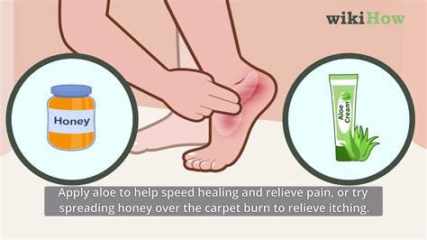 How To Treat Carpet Burn Scar | www.resnooze.com