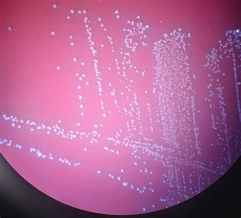 Aerococcus urinae | Wiki | Everipedia