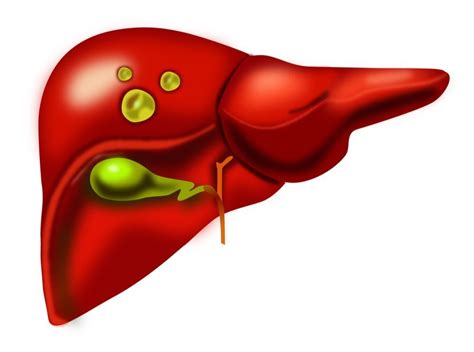 Dissolve Liver Cyst Treatment Service at Rs 1111 in Noida