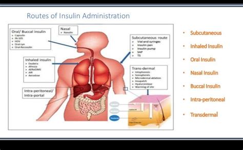 INSULIN DELIVERY METHODS : Overview on Past, Present and Future