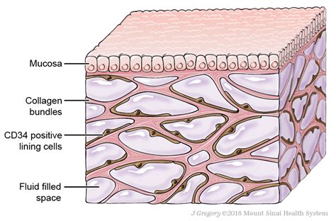 Interstitium: Bringing It All Together