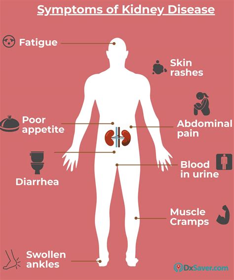 Kidney Infection