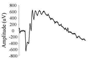 electroretinography — https://eyecro.com