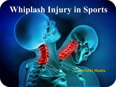 WHIPLASH INJURIES IN SPORTS INDIVIDUALS | PPT