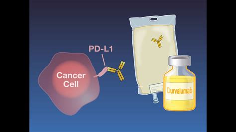 Perioperative Chemoimmunotherapy in Lung Cancer | NEJM - YouTube