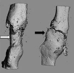 Hydroxyapatite Bone Grafts