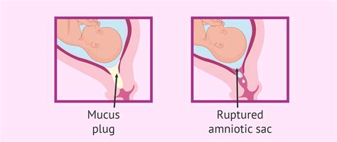 what does the mucus plug look like - prenatal vitamins