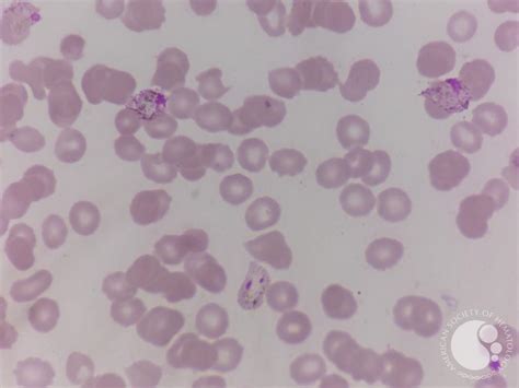 Plasmodium vivax gametocytes