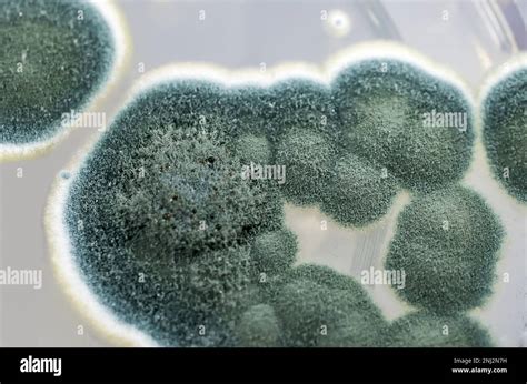 Penicillium mold spores hyphae hi-res stock photography and images - Alamy