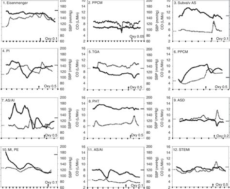 This figure shows the changes in cardiac output (CO) and systolic blood ...