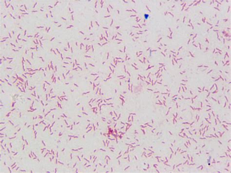 Exam 1: Microscopy of Infectious Disease at Loyola University Chicago - StudyBlue