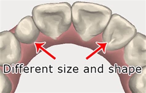 Rooster Teeth Size Chart: A Visual Reference of Charts | Chart Master