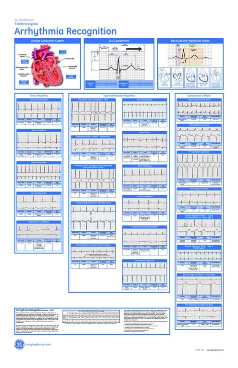 Ekg Interpretation Cheat Sheet Printable - Printable Templates