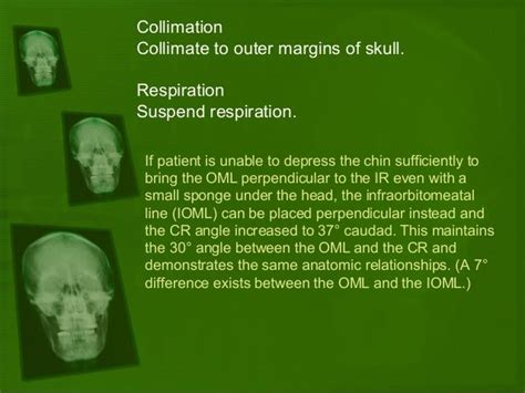 Positioning and radiographic anatomy of the skull X Ray Tube, Sagittal Plane, Maxillary Sinus ...