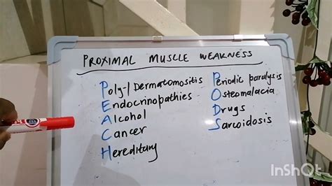 Mnemonic 10 : Proximal muscle weakness - YouTube