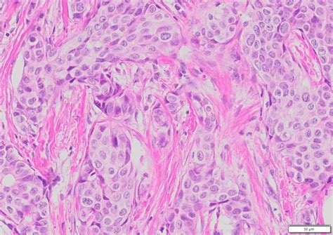 VitroView™ Hematoxylin and Eosin Stain Kit (500 ml per bottle) - a general purpose tissue staining