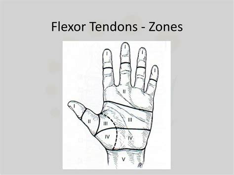 Flexor Zones Of The Hand