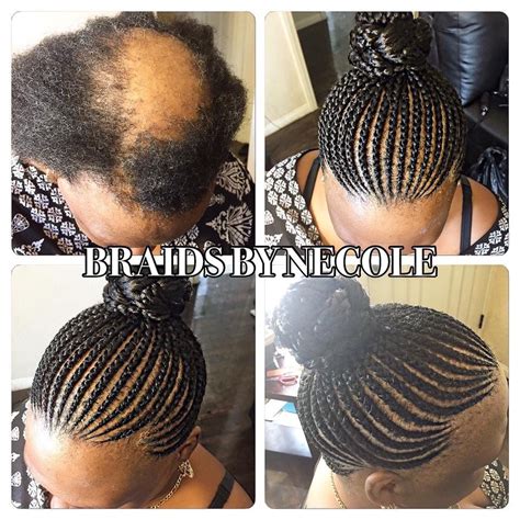 Braided Hairstyles To Cover Bald Spots - Hairstyle Guides