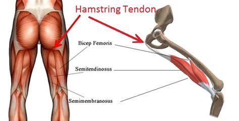 Hamstring Tendinopathy in Runners | Physio 4 Richmond