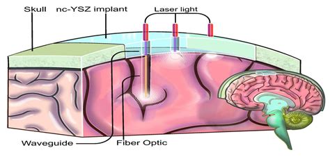 Scientists move closer to developing therapeutic window to the brain